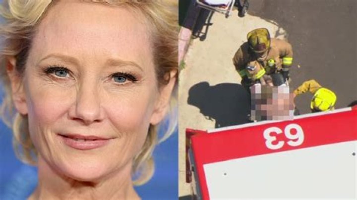 
Anne Heche Illness And Health Update: What Is Her Condition Now After The Accident? 