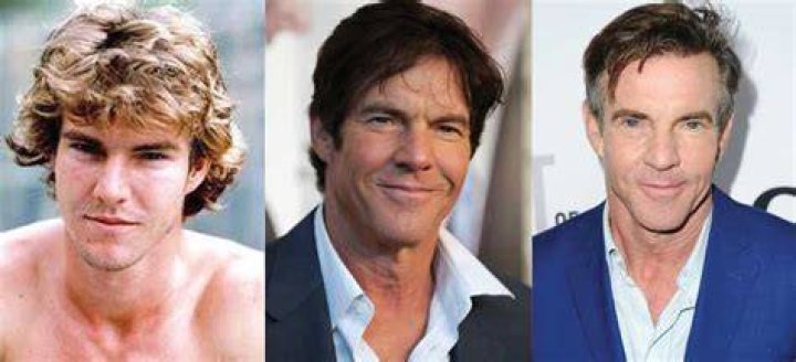Dennis Quaid Plastic Surgery, Before After Pics – Age And Height Revealed