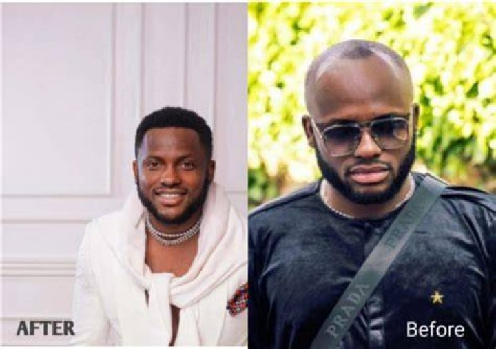 
I Go Save Shows Off Transformation Following $20k Hair Transplant 
