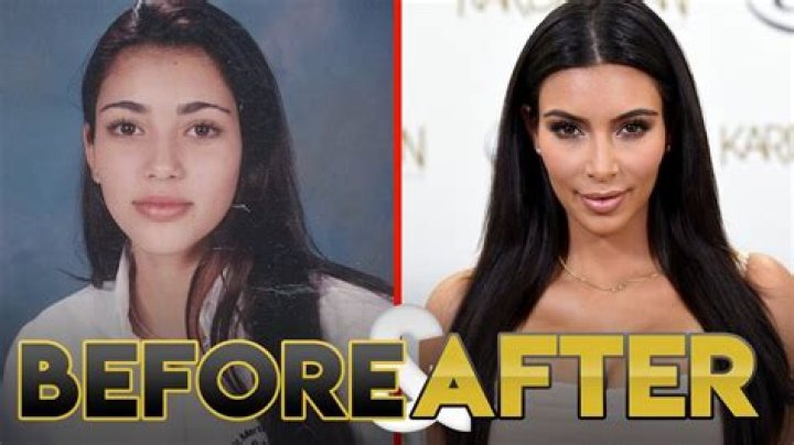 
Kim Lee Before And After Plastic Surgery, Who Is Kim Lee? 
