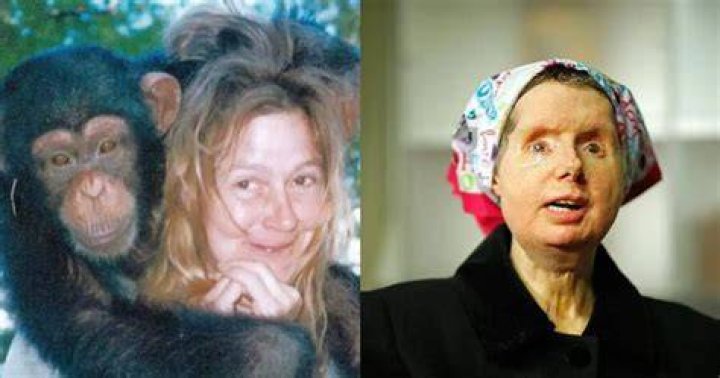Where Is Charla Nash Now? Travis The Chimp Victim – Age Husband And Face Condition 2022