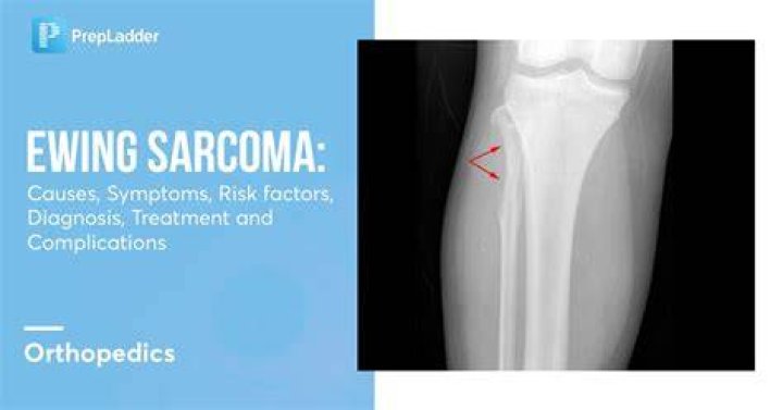 
Who Is Carlos Sarria On TikTok? A Long Battle Of Sarcoma De Ewing Cancer 
