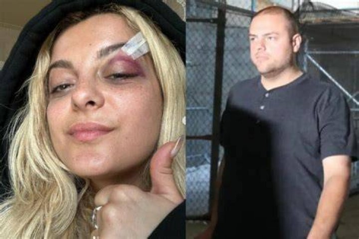 Who is Nicolas Malvagna? Man allegedly threw cell phone at Bebe Rexha during New York concert